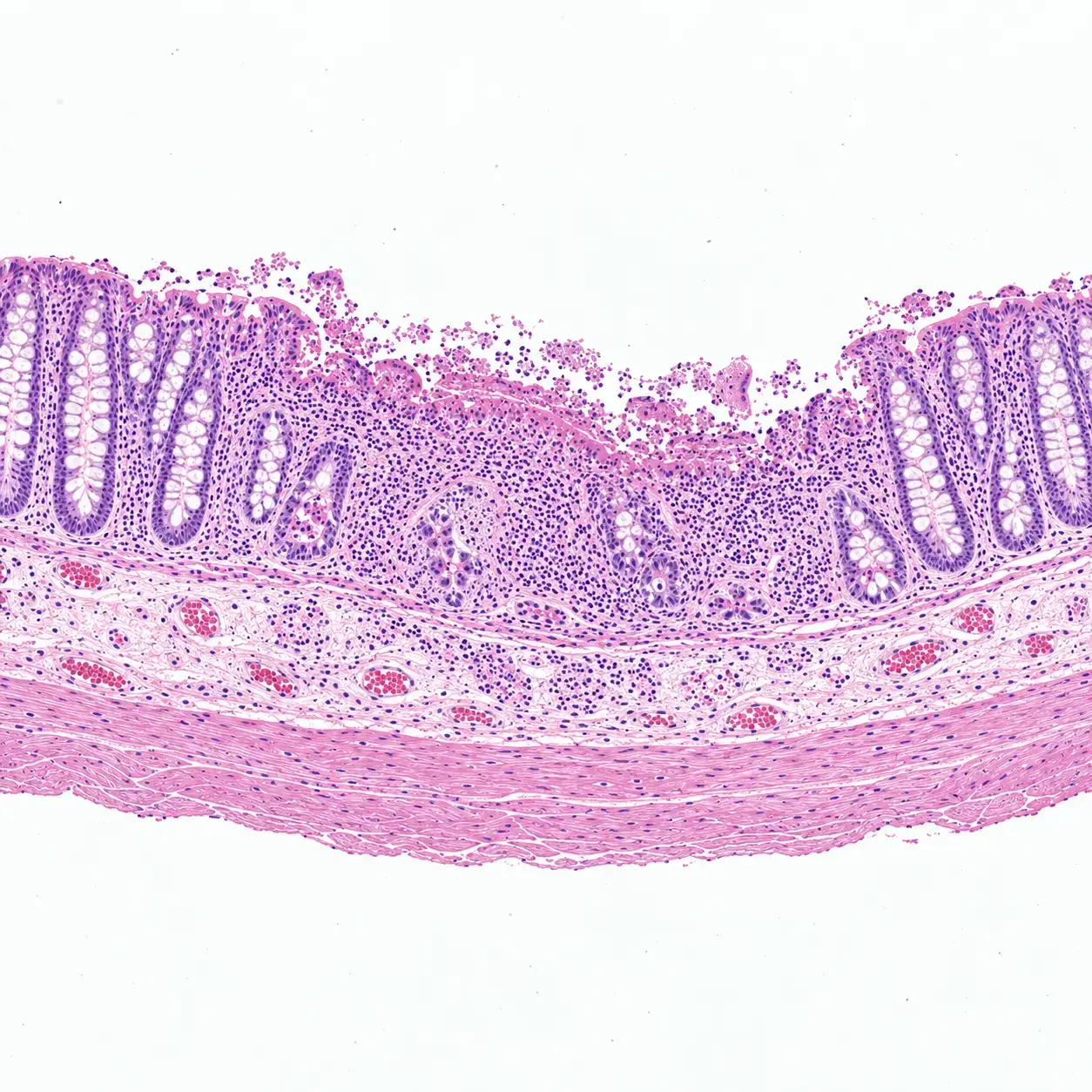 Laboratory research supporting inflammatory bowel disease studies