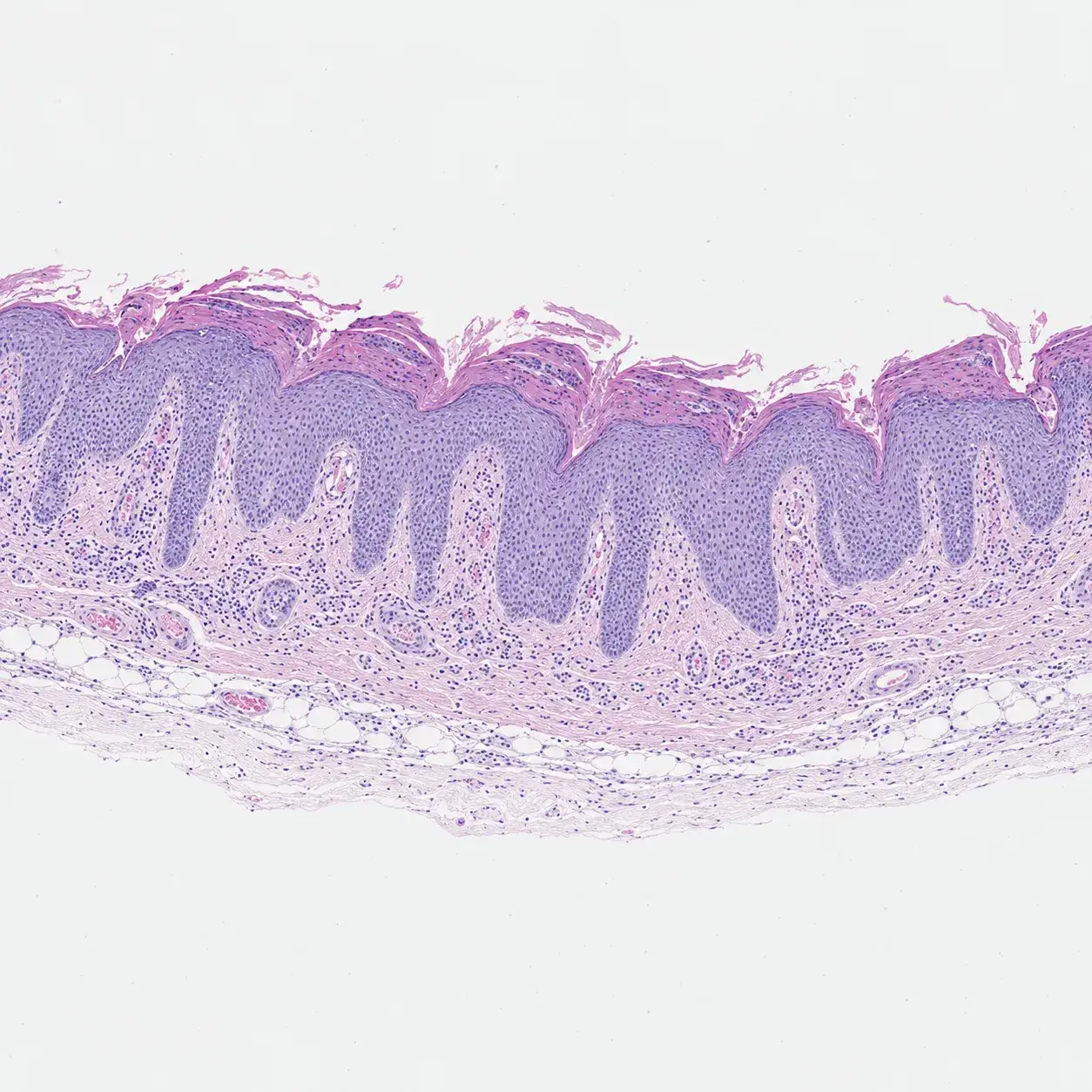 Laboratory research supporting inflammatory skin disease studies