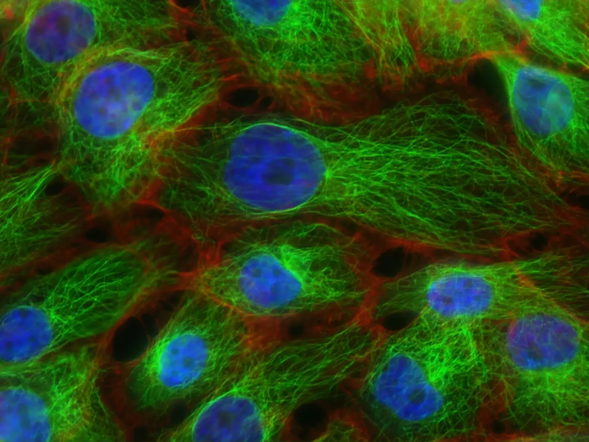 Microscopic view of stained cancer cells used in oncology research