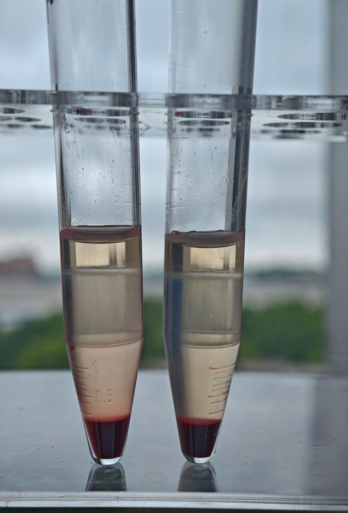 Leecoll density-gradient separation of mouse blood cells